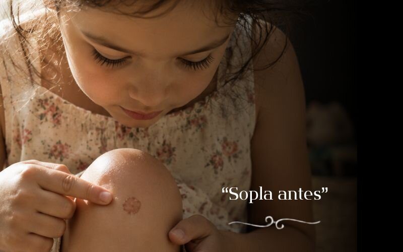 80-Sopla antes